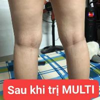 Kem rạn da multi 16 hủ nhỏ 20g