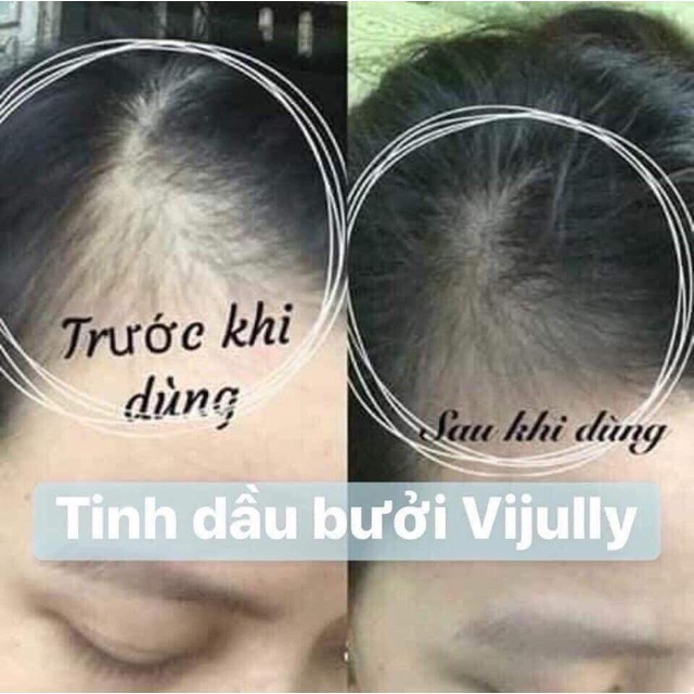 [CHÍNH HÃNG 100%] Combo Bộ Dầu Gội+Xả+Tinh Dầu Bưởi ViJully xịt dưỡng kích thích mọc ngăn rụng tóc