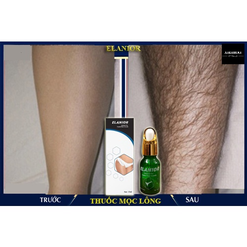 Serum Hỗ Trợ Mọc Lông Chân Cho Nam - Che tên sản phẩm khi giao