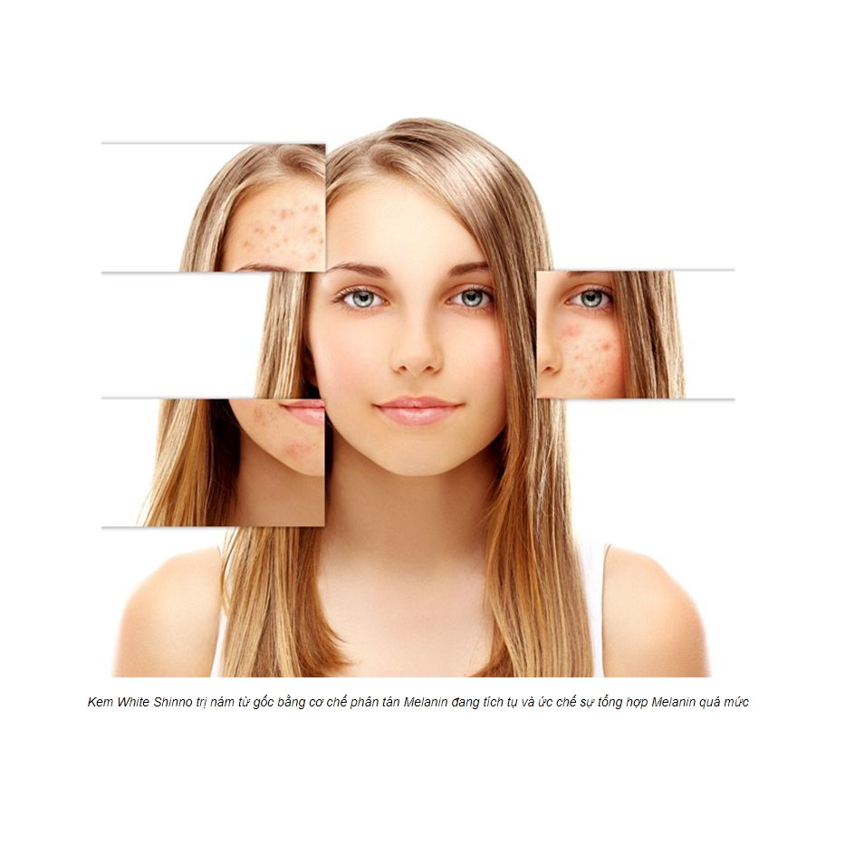 Kem làm mờ thâm nám và dưỡng trắng da White Shinno Nhật Bản
