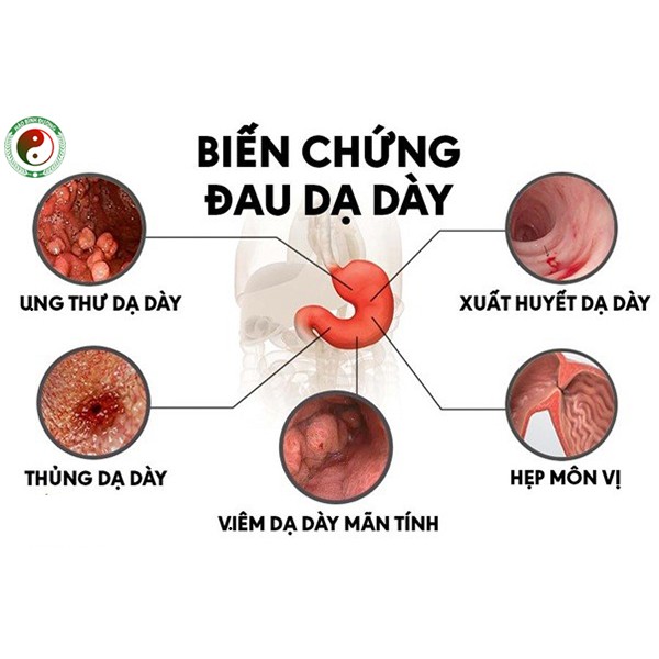 Lá Dạ Dày Dân Tộc Dao Giúp Tiêu Hóa Tốt Giúp Ăn Ngon Giảm Đầy Bụng