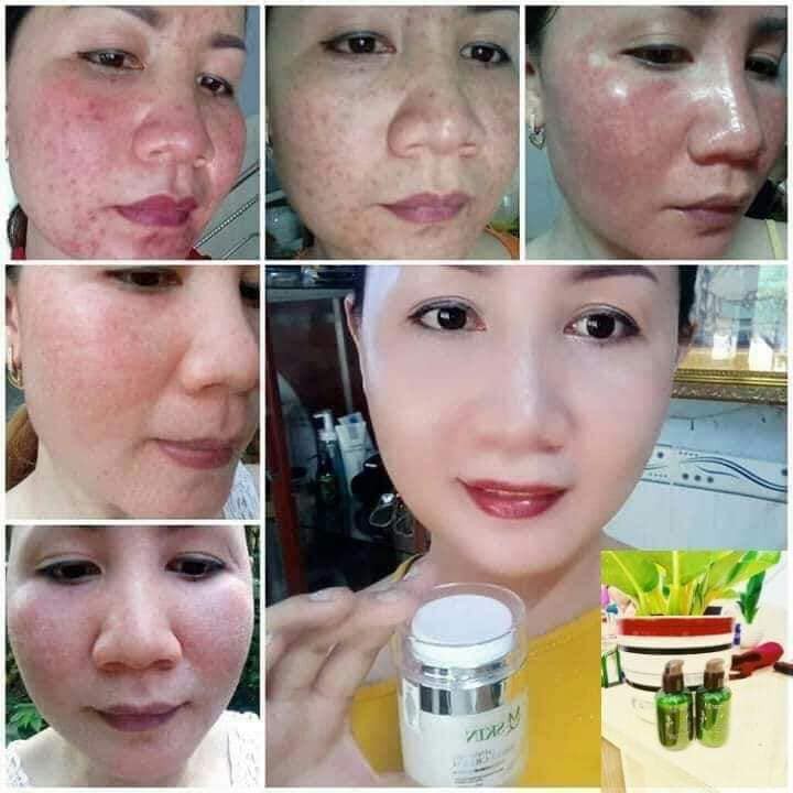 (Chính Hãng) Kem Face Nhân Sâm MQ Skin Dưỡng Da Chống Nắng