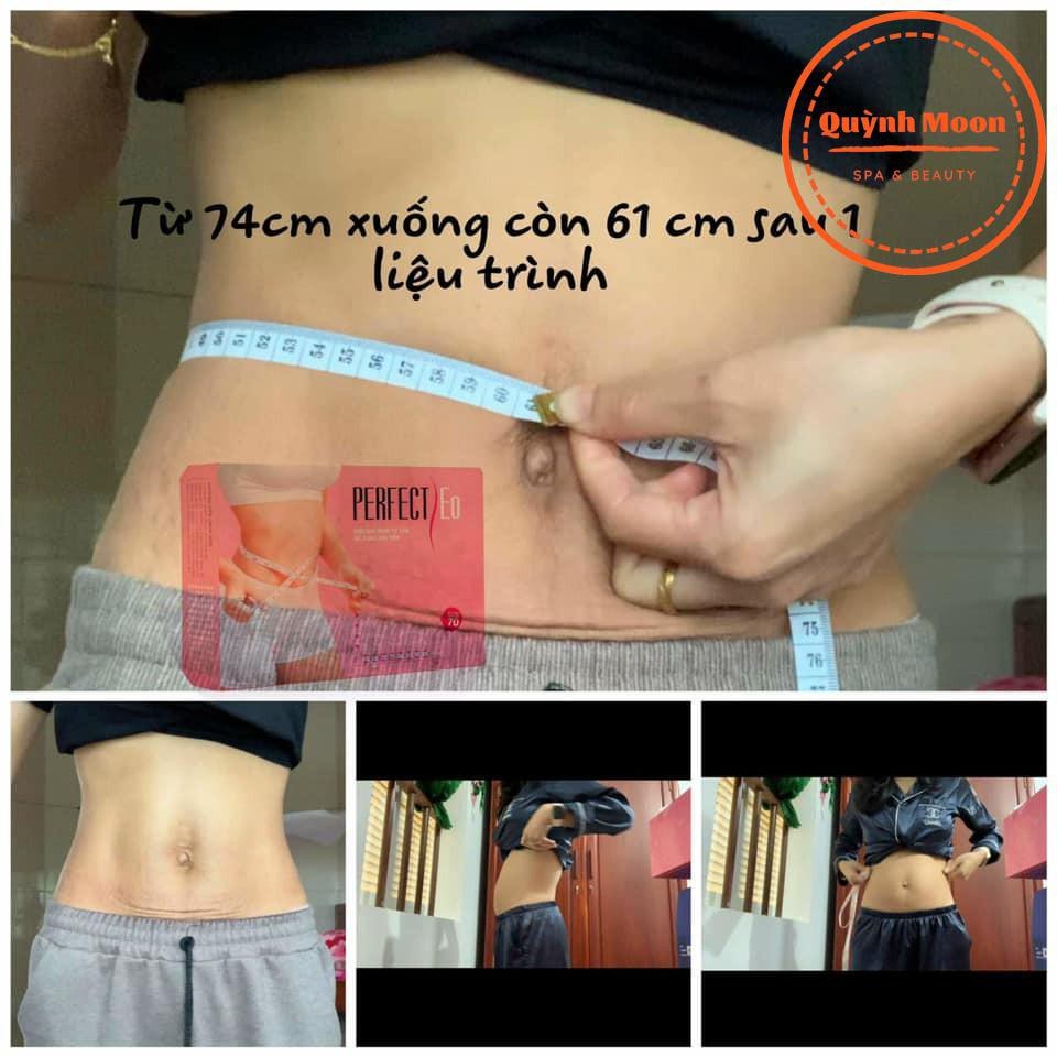 Đai nịt bụng giảm tan mỡ sau sinh perfect eo, kem tan mỡ bụng