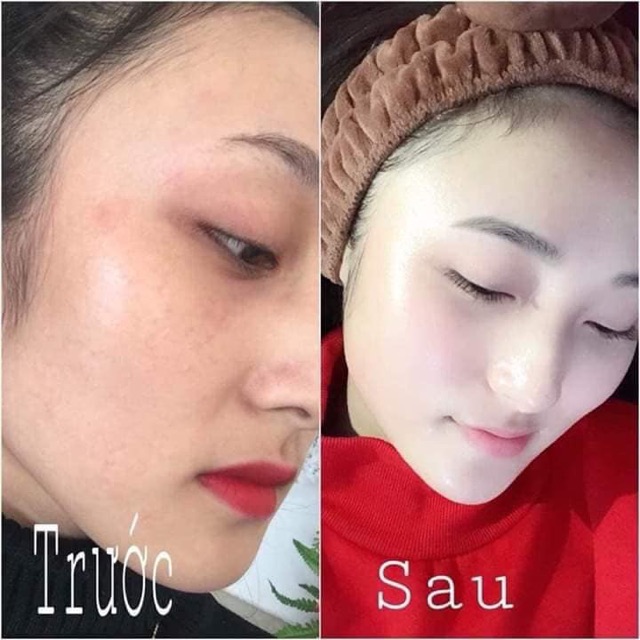 KEM DƯỠNG DA ONSAEMEEIN - LÀN DA CĂNG BÓNG CHUẨN HÀN QUỐC | BigBuy360 - bigbuy360.vn