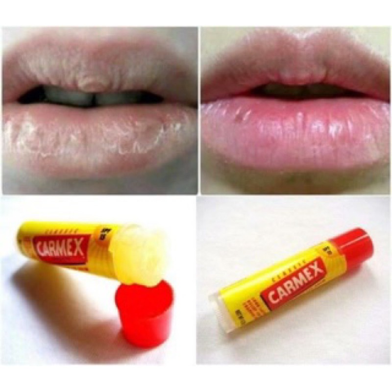 Son Dưỡng Môi Carmex Classic Lip Balm Medicated SPF15