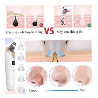 Máy Hút Mụn Đầu Đen Làm Sạch Da Mặt Sạc Pin [ 5 Đầu Hút}