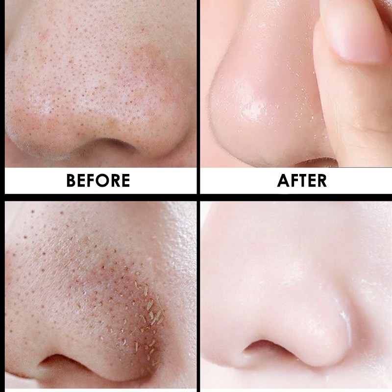 Mặt Nạ Lột Mụn Đầu Đen Thu Nhỏ Lỗ Chân Lông Chăm Sóc Da 20g