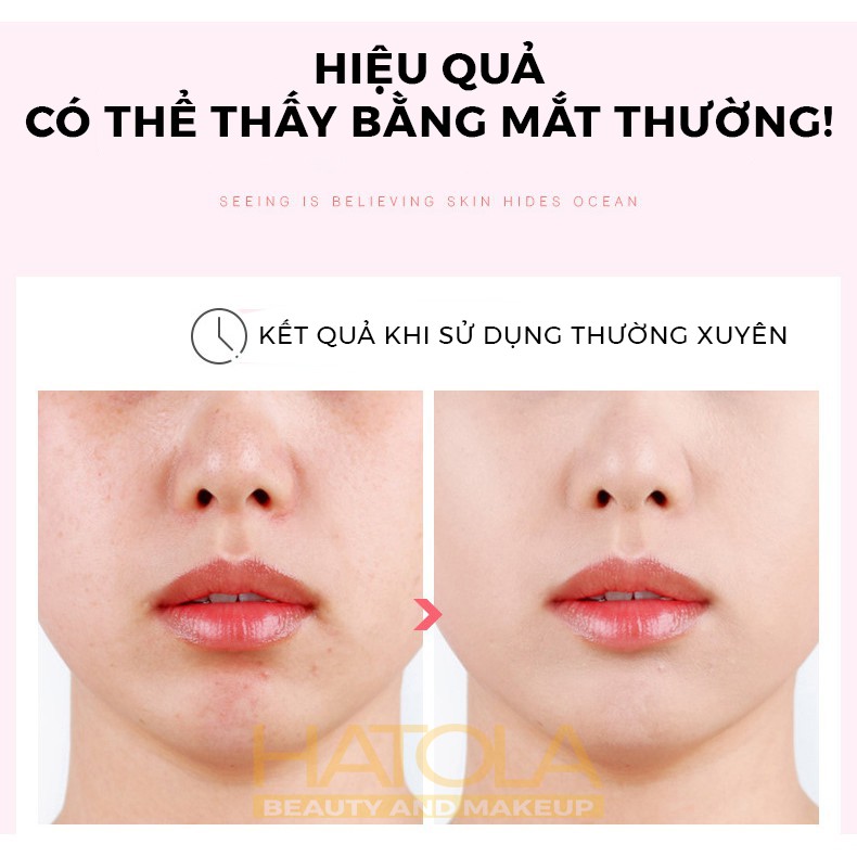 Kem Dưỡng Ẩm Trắng Da Cream Laikou Sáng Mịn Và Trẻ Hóa Làn Da Chiết xuất Hoa Anh Đào Hatola