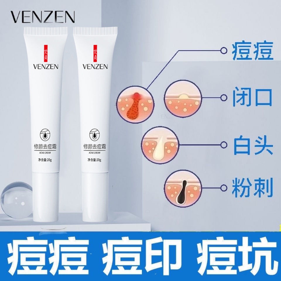 Kem Hỗ Trợ Giảm Mụn Trứng Cá Làm Mờ Vết Thâm Mụn Phục Hồi Miệng Trẻ Hóa Làn Da Cho Học Sinh Manshanzc.My11.27 | BigBuy360 - bigbuy360.vn