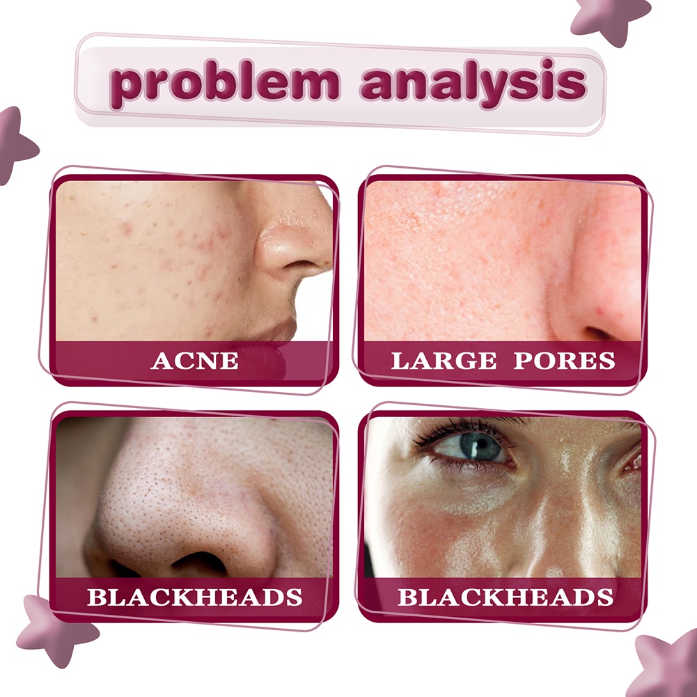 Tinh Chất Axit Salicylic Trái Cây Làm Sạch Lỗ Chân Lông Loại Bỏ Mụn Đầu Đen Chăm Sóc Da Mặt Jaysuing 30ML