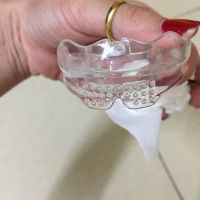 (A1+A2+A3) DỤNG CỤ NIỀNG RĂNG CHO NGƯỜI LỚN