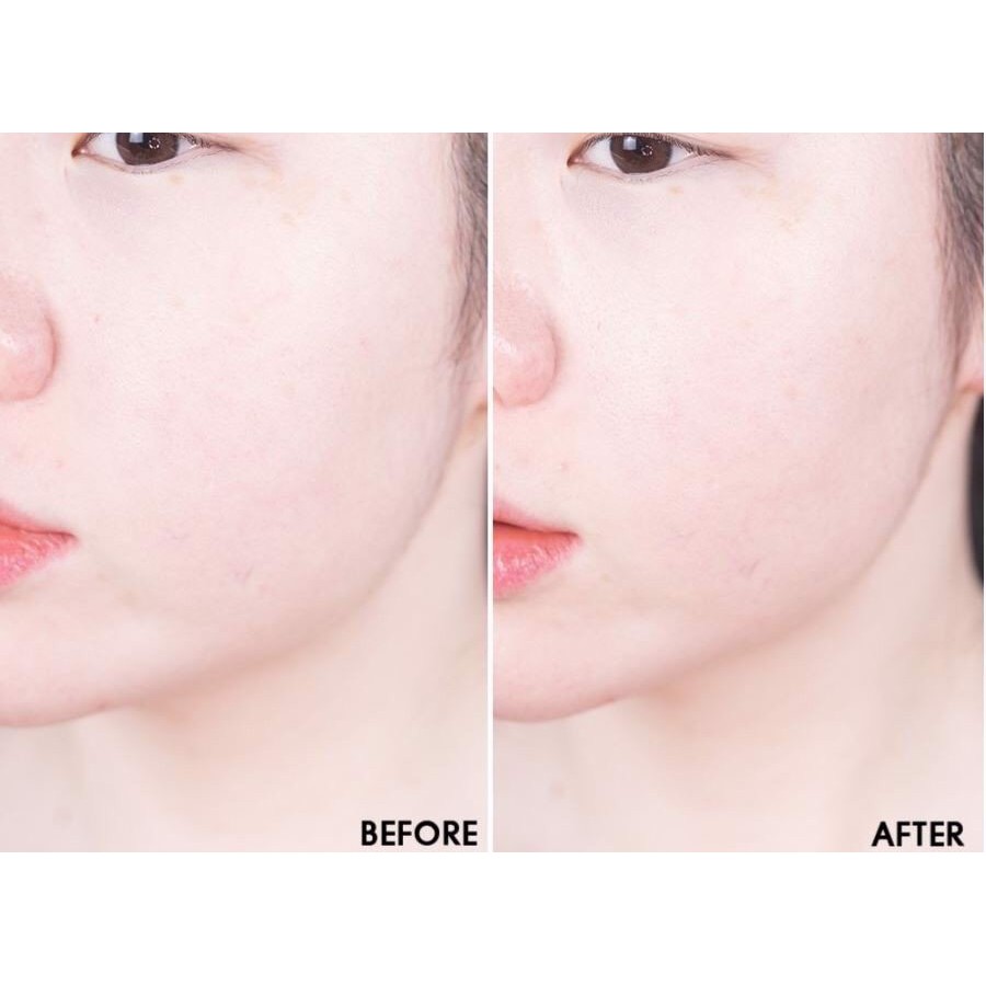 Nước Hoa Hồng Some By Mi Yuja Niacin 30Days Miracle Brightening Toner