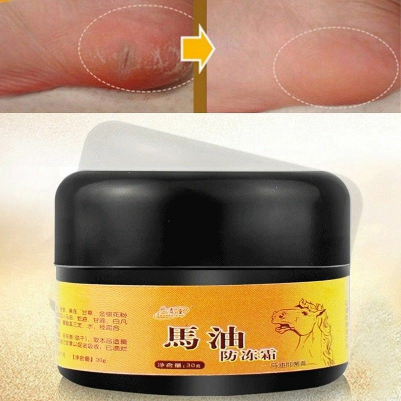 Kem Dầu Ngựa Dưỡng Da Chân Chống Khô / Nứt Nẻ Yingyingfu 30ml