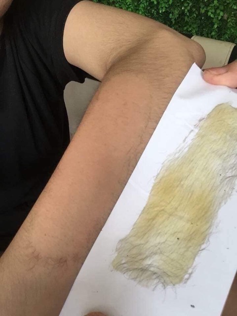 [Chính hãng] Combo Triệt Lông an toàn hiệu quả tại nhà | BigBuy360 - bigbuy360.vn