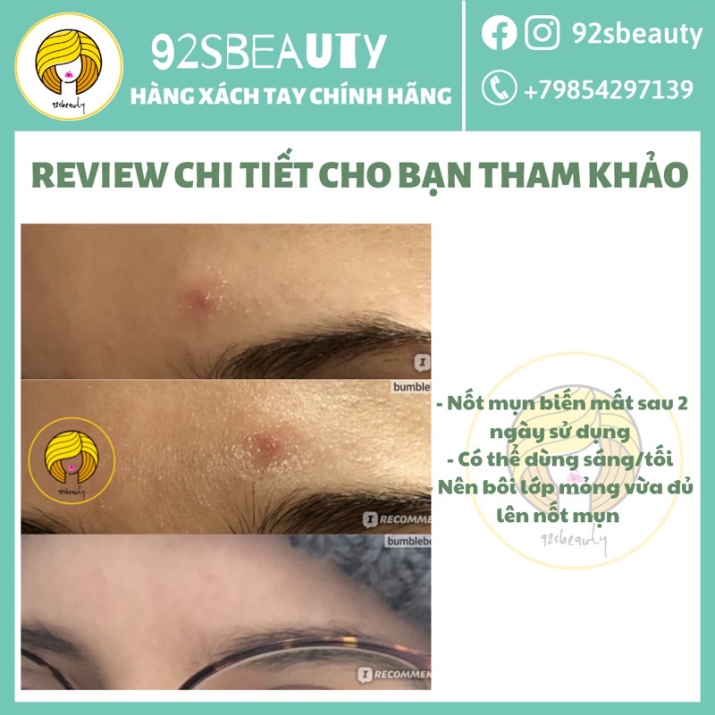 Gel BHA chấm mụn Compliment không chứa cồn giúp giảm mụn hiệu quả