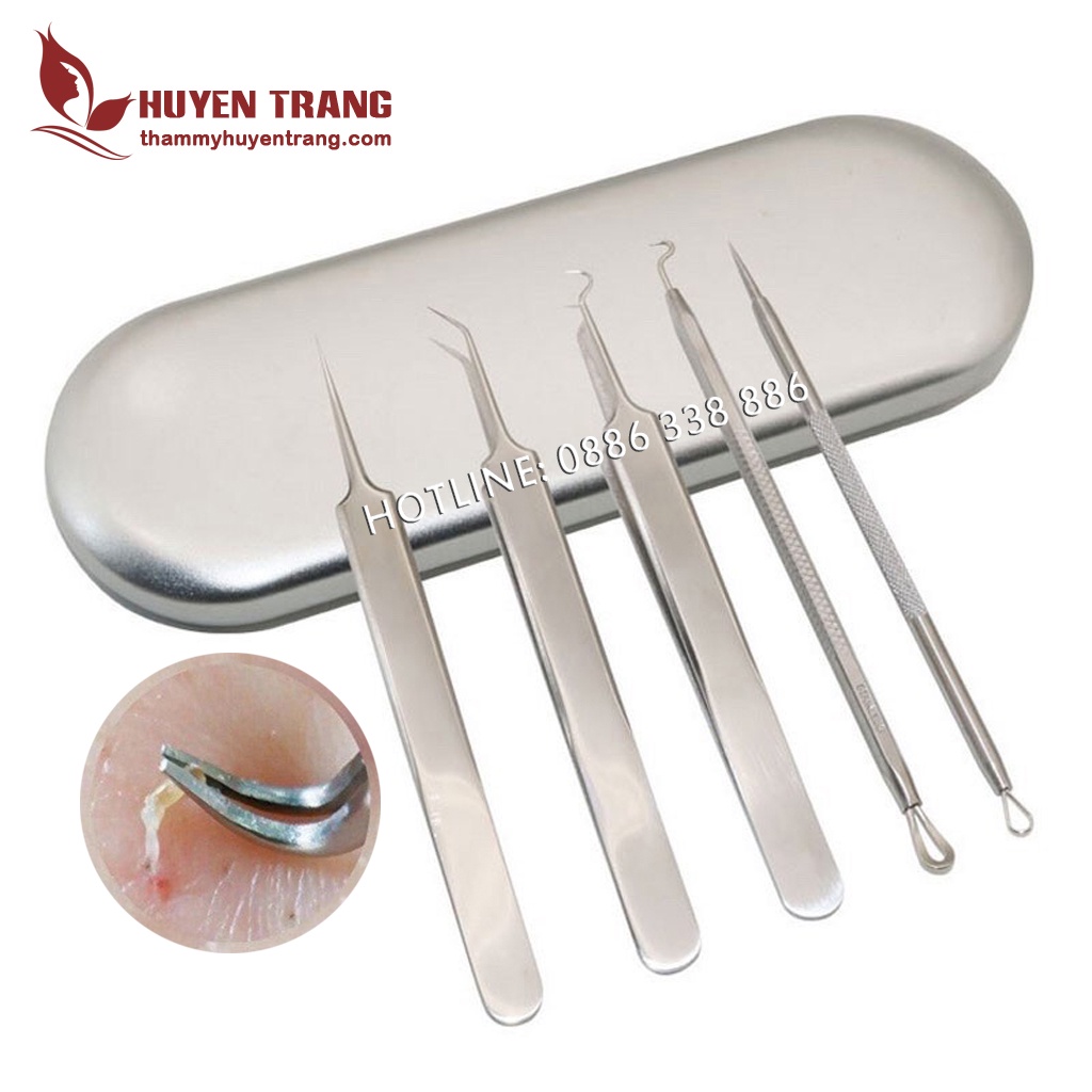 Bộ Dụng Cụ Nặn Mụn 5 Món: 3 Nhíp Lấy Mụn Và 2 Que Nặn Mụn Cao Cấp Không Gỉ - Thẩm Mỹ Huyền Trang