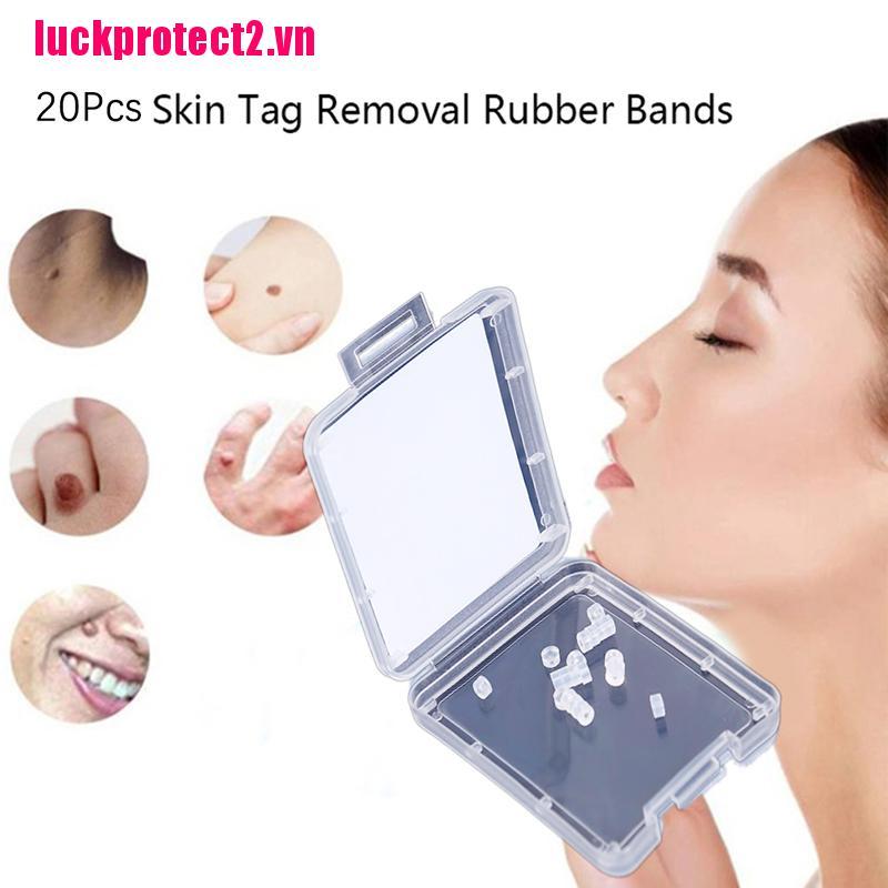 H&L 20Pcs Skin Tag Removal Rubber Bands Micro Band Non Toxic Face Care Mole Wart