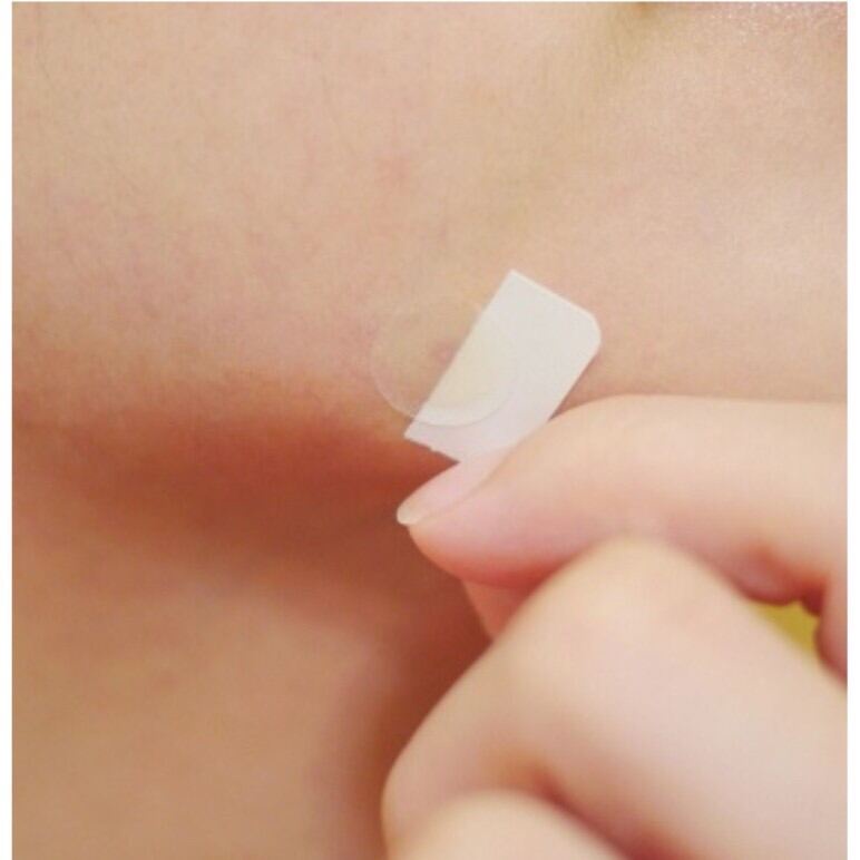 Miếng dán mụn dùng cho ban đêm  DERMA ANGEL