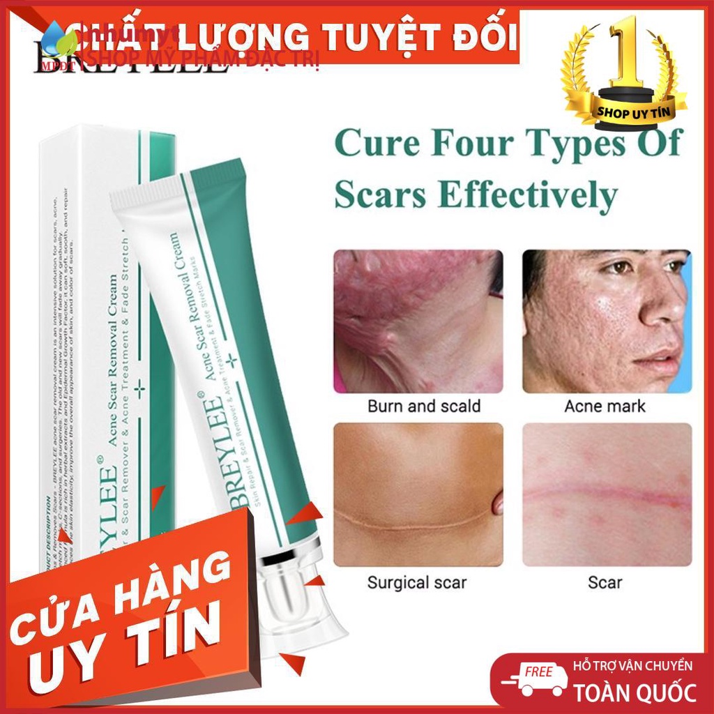 Kem mờ sẹo làm trắng da, mờ thâm sẹo | BigBuy360 - bigbuy360.vn