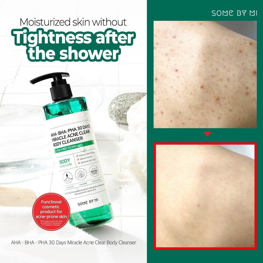 [CHÍNH HÃNG] Sữa Tắm Làm Giảm Mụn SOME BY MI AHA-BHA-PHA 30 Days Miracle Acne Clear Body Cleanser 400g