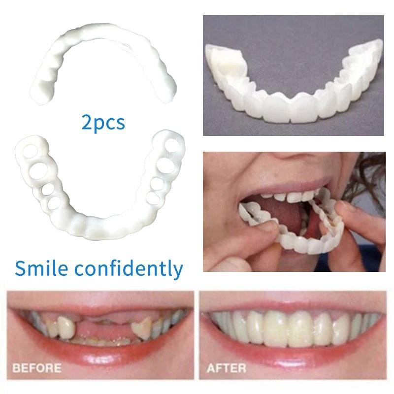 Dụng cụ niềng răng tại nhà snapon smile - nẹp răng tại nhà