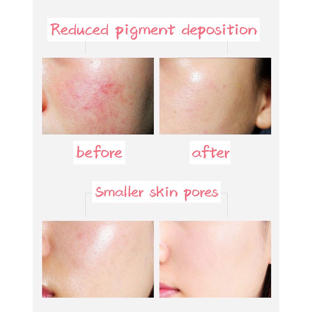 Sữa rửa mặt làm trắng da kiểm soát dầu 120g