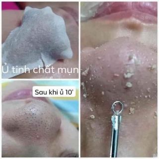 Ủ Mụn Lamer Care