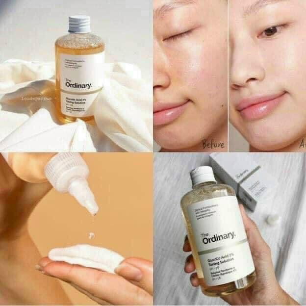 Toner tẩy da chết làm sạch The Ordinary Glycolic Acid 7% Toning Solution