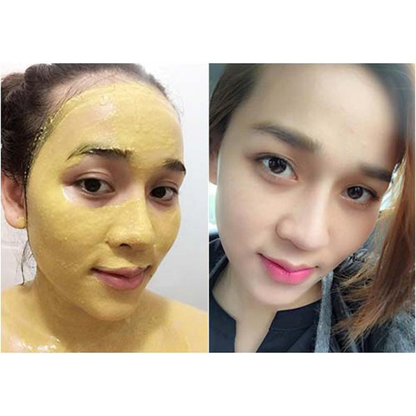 👍[100% Chính Hãng] Cao Tinh Nghệ MPĐT Trắng Da, Mờ Thâm, Ngừa Mụn, Se Lỗ Chân Lông, Hút Sắc Tố | BigBuy360 - bigbuy360.vn