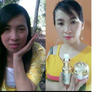 Combo serum collagen, kem face BN White