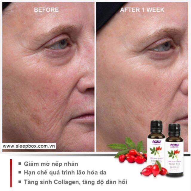 Tinh dầu nụ tầm xuân Now Rosehip Seed Oid 10ml và 30ml - Mỹ