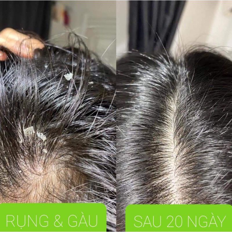 Dầu gội bồ kết thảo dược cô đặc sạch gàu mọc tóc, chống rụng tóc, hết nấm ngứa da đầu - Handmade từ Thị ☘️ | BigBuy360 - bigbuy360.vn