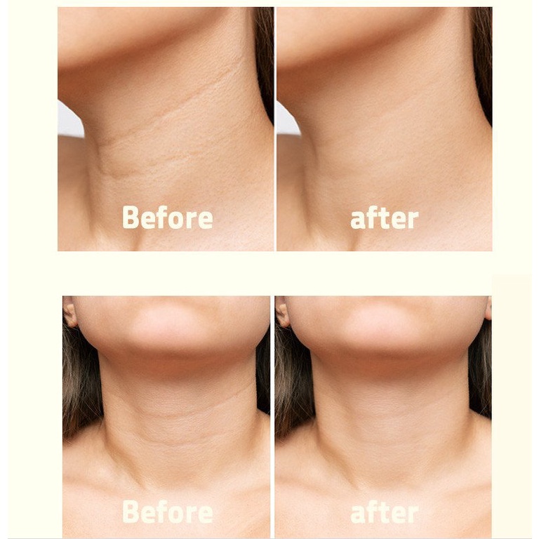 Mặt nạ nâng cơ vùng cổ Cos-Up Esthetic Solution Neck Lifting Mask 12gr