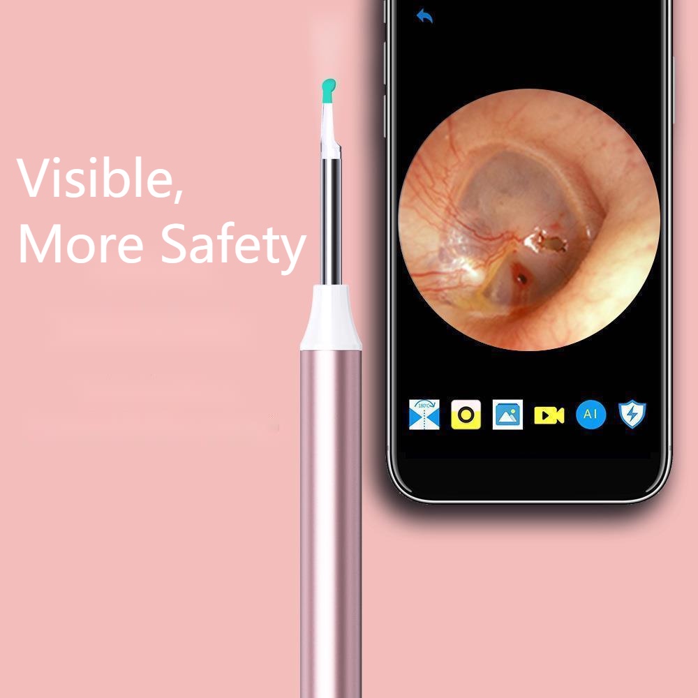 Bộ Dụng Cụ Lấy Ráy Tai Bằng WiFi Không Dây Chất Lượng Cao