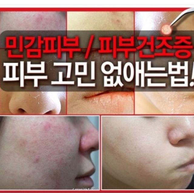 3 ống huyết thanh trắng da + 1 hũ kem tế bào gốc 4D Dr.laksmira