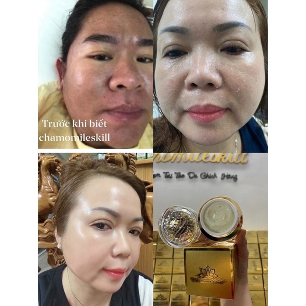 Kem tái tạo chamomileskill