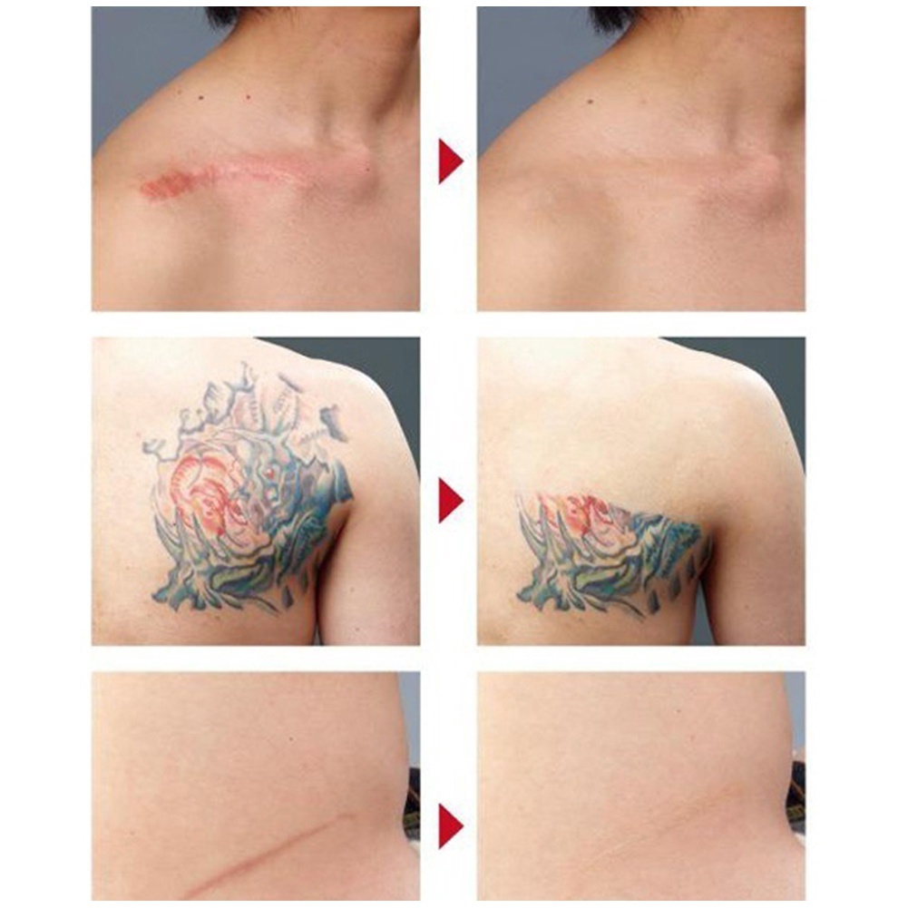 Kem Che Khuyết Điểm Che Phủ Quầng Thâm Và Mụn Làm Trắng Da