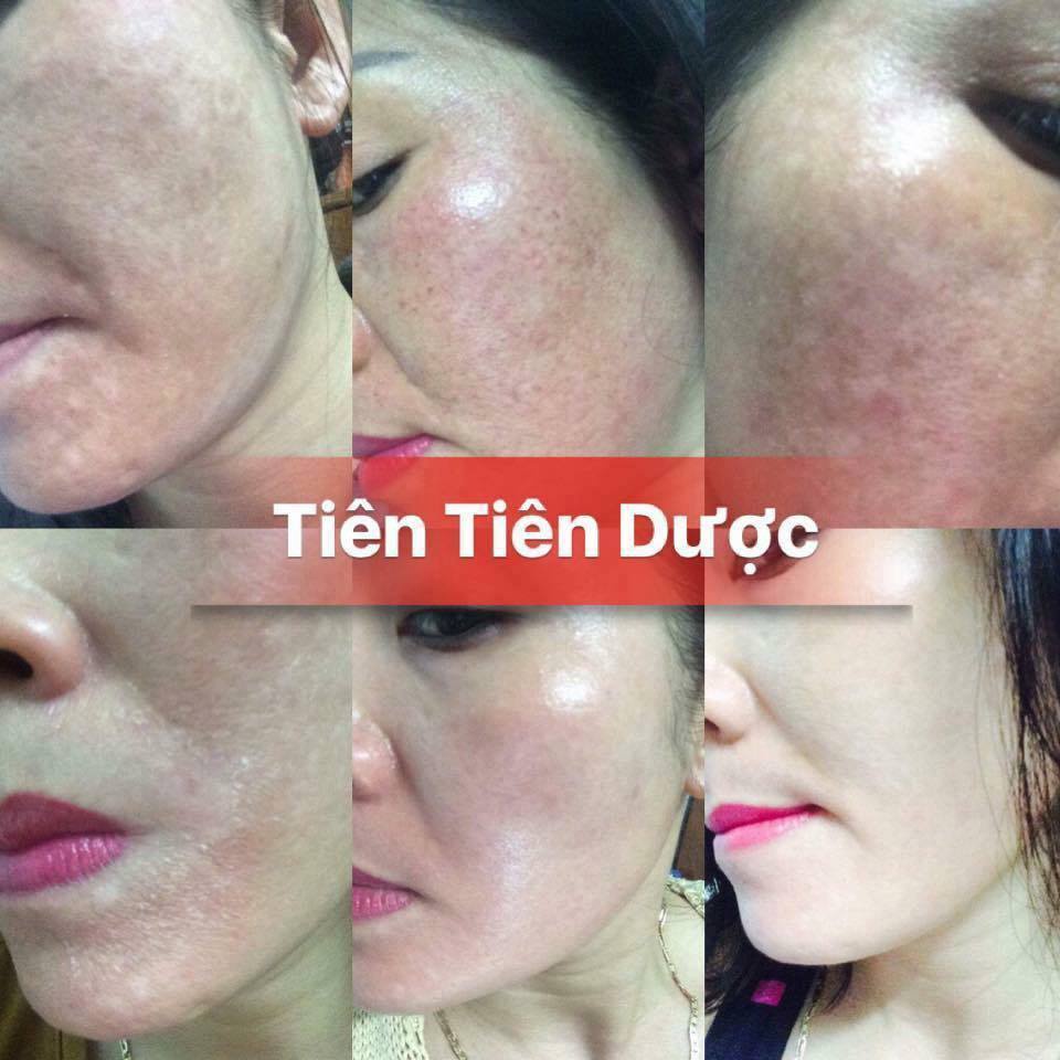 Tinh chất tái tạo da Tiên Tiên Dược 100ml