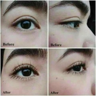 Serum mọc TÓC - RÂU - CHÂN MÀY