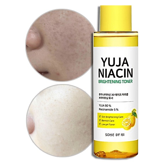 Nước Hoa Hồng Dưỡng Ẩm, Làm Trắng Da, Mờ Thâm Some By Mi Yuja Niacin Brightening Toner 150ml