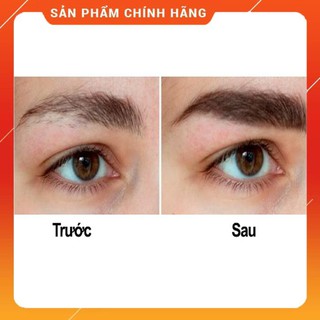 Thuốc mọc chân mày Dr.EyeBrowes