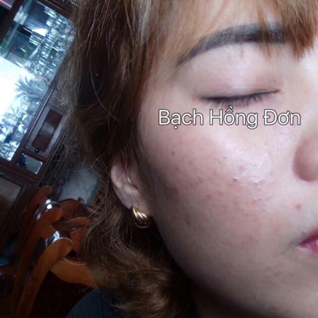 Bạch Hồng Đơn | BigBuy360 - bigbuy360.vn