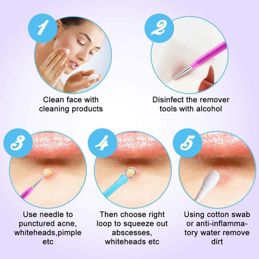 Bộ Dụng Cụ Nặn Mụn Bằng Thép Không Gỉ Thiết Kế Nhỏ Gọn Tiện Dụng