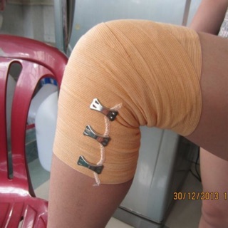BĂNG THUN QUANG MINH 3 móc