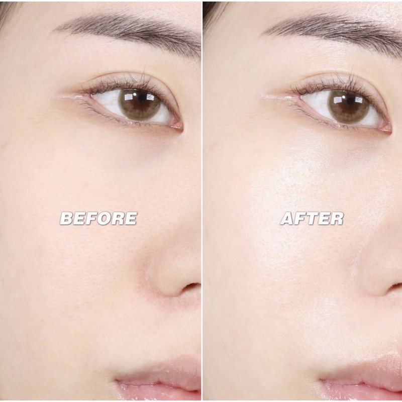 Kem Cell Fusion C Laser Rejuvenation Cream dưỡng ẩm phục hồi tái tạo da