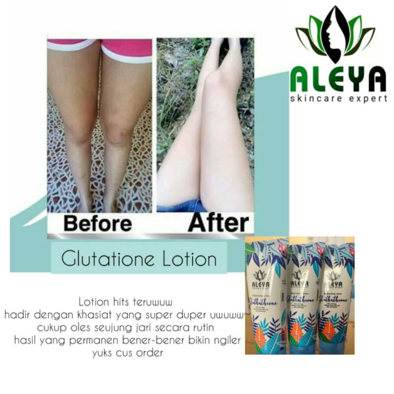 (hàng Mới Về) Lotion Dưỡng Trắng Da Aleya