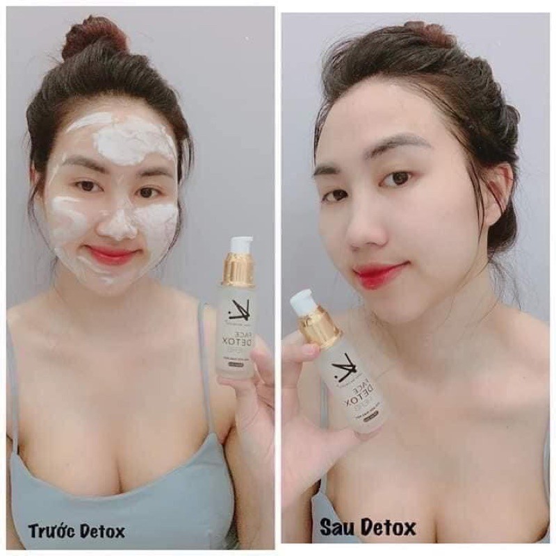 DETOX SỦI BỌT THẢI CHÌ CHO DA (kay beauty) | BigBuy360 - bigbuy360.vn