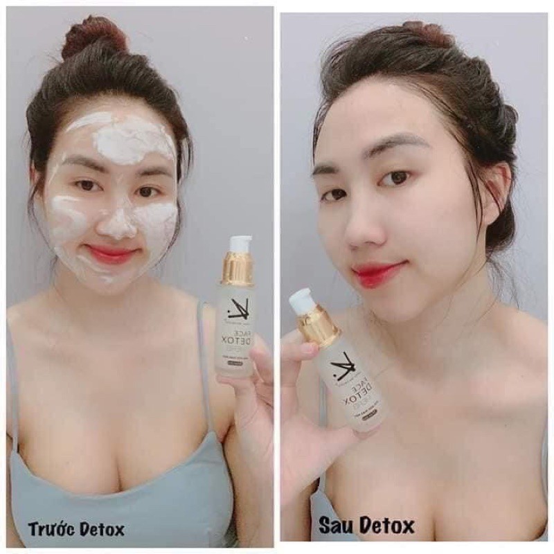 DETOX SỦI BỌT THẢI CHÌ CHO DA (kay beauty)