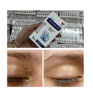 ºGel Dvelinil tẩy nốt ruồi, mụn cóc, mụn thịt, sẹo lồi – Nga