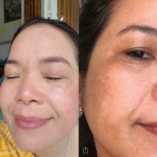 KEM SÂM NHẬT CHÍNH HÃNG - NÁM - MỤN - THÂM - TÀN NHANG HIỆU QUẢ | BigBuy360 - bigbuy360.vn